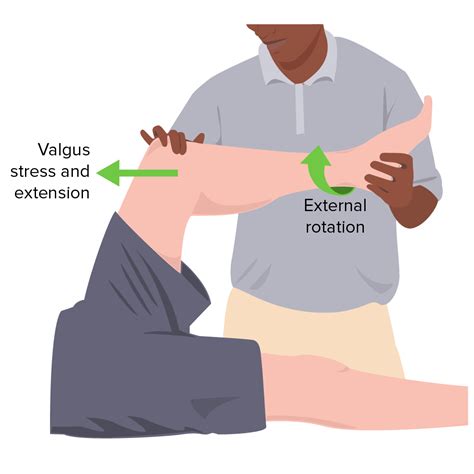 squat test for meniscal tear|diagnose meniscus tear without mri.